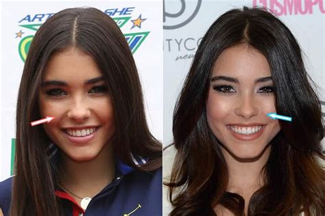 Madison Beer Plastic Surgery: Quotes, Before, After。